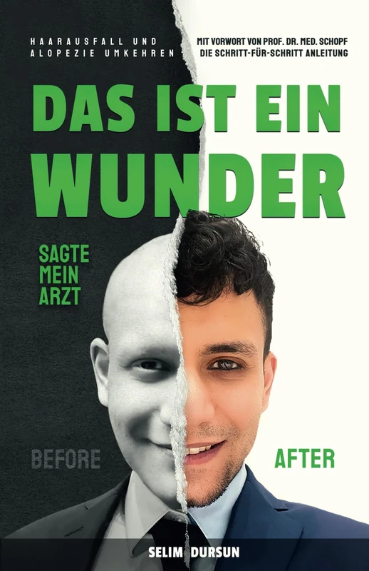 DAS IST EIN WUNDER SAGTE MEIN ARZT: HAARVERLUST UND ALOPEZIE UMKEHREN