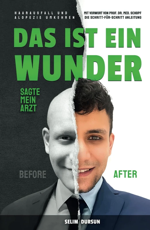 DAS IST EIN WUNDER SAGTE MEIN ARZT: HAARVERLUST UND ALOPEZIE UMKEHREN