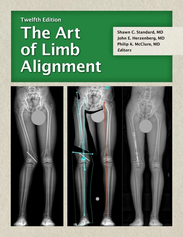 The Art of Limb Alignment, Twelfth Edition