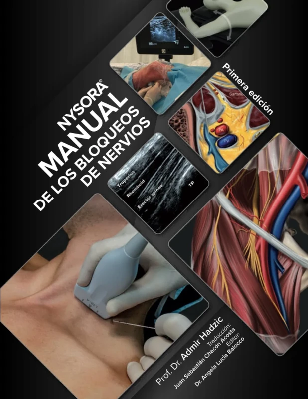 NYSORA Manual de los Bloqueos de Nervios: Primera Edición
