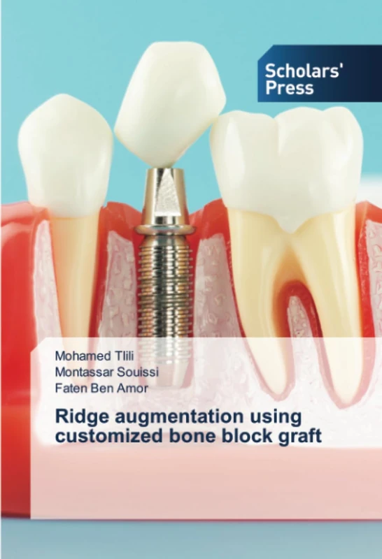Ridge augmentation using customized bone block graft