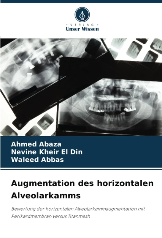 Augmentation des horizontalen Alveolarkamms: Bewertung der horizontalen Alveolarkammaugmentation mit Perikardmembran versus Titanmesh