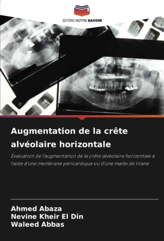 Augmentation de la crête alvéolaire horizontale: Évaluation de l'augmentation de la crête alvéolaire horizontale à l'aide d'une membrane péricardique ou d'une maille de titane - Image 1