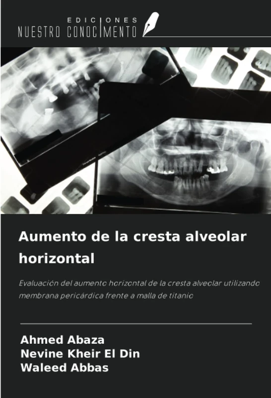 Aumento de la cresta alveolar horizontal: Evaluación del aumento horizontal de la cresta alveolar utilizando membrana pericárdica frente a malla de titanio - Image 1