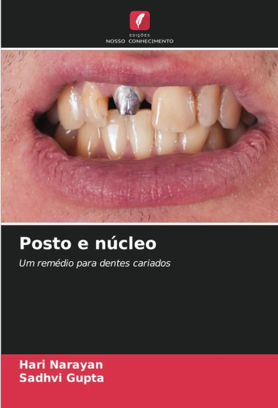 Posto e núcleo: Um remédio para dentes cariados