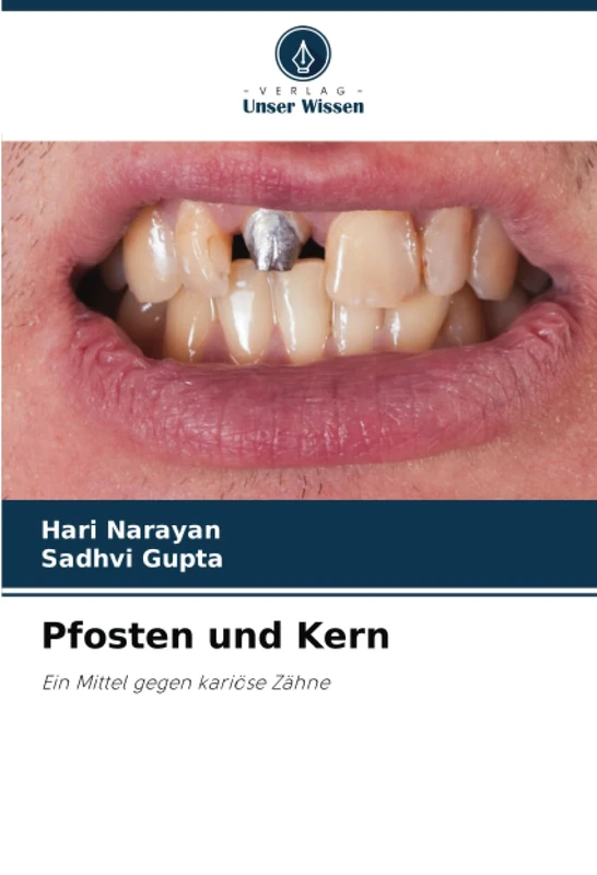 Pfosten und Kern: Ein Mittel gegen kariöse Zähne