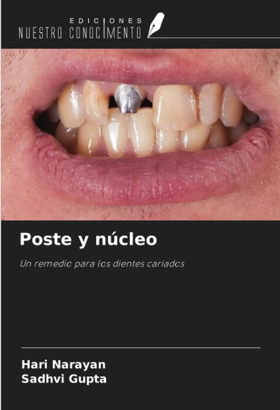 Poste y núcleo: Un remedio para los dientes cariados