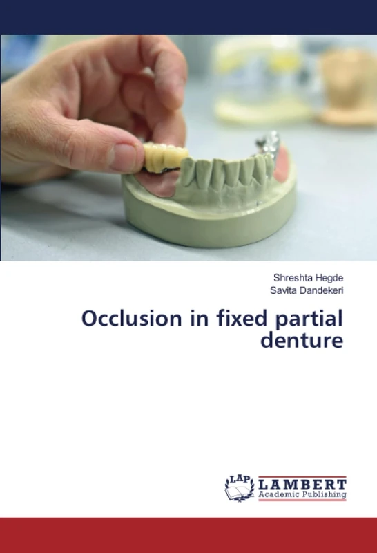 Occlusion in fixed partial denture