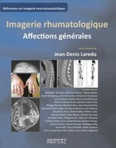 Imagerie rhumatologique: Affections générales