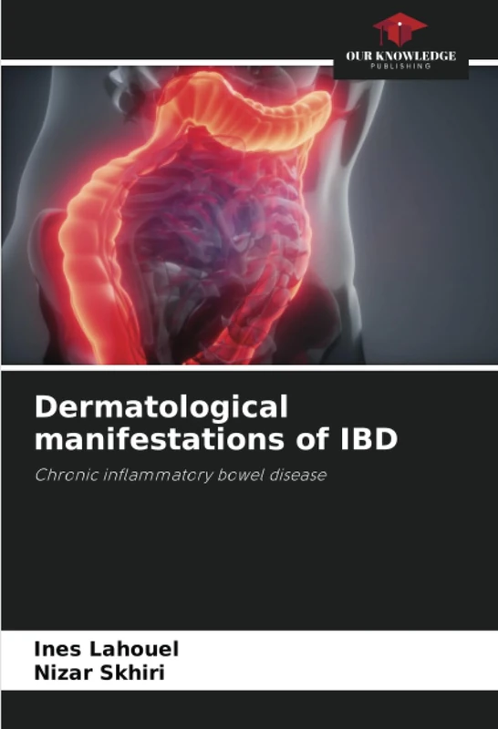Dermatological manifestations of IBD: Chronic inflammatory bowel disease