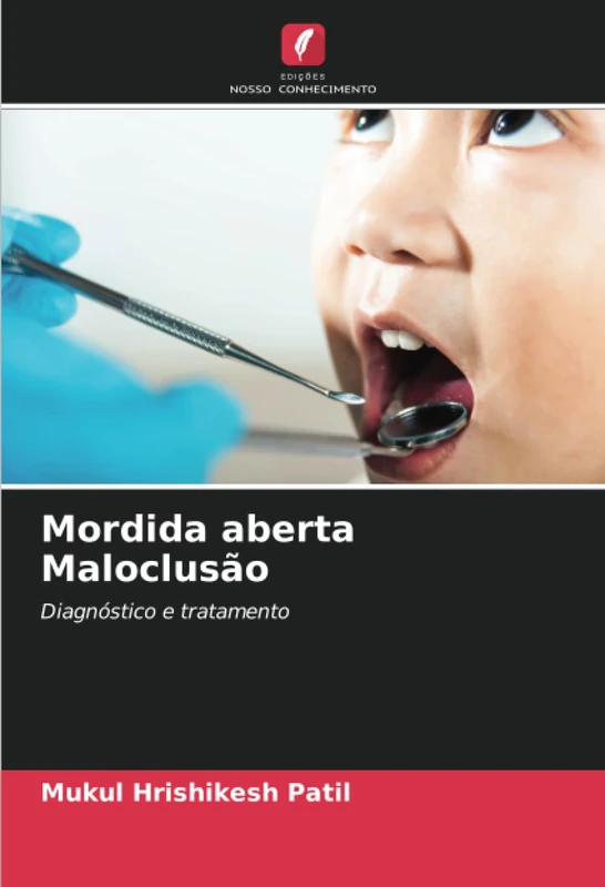 Mordida aberta Maloclusão: Diagnóstico e tratamento