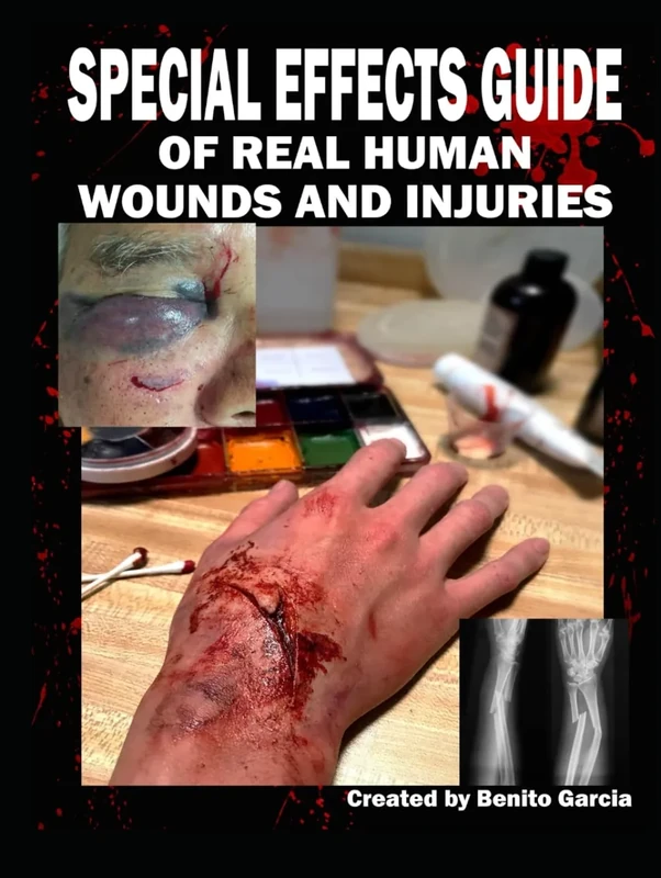 Special Effects Guide Of Real Human Wounds and Injuries: Special Effects Guide Of Real Human Wounds and Injuries