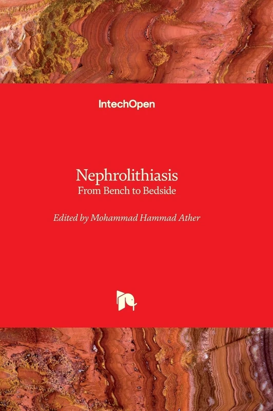 Nephrolithiasis - From Bench to Bedside