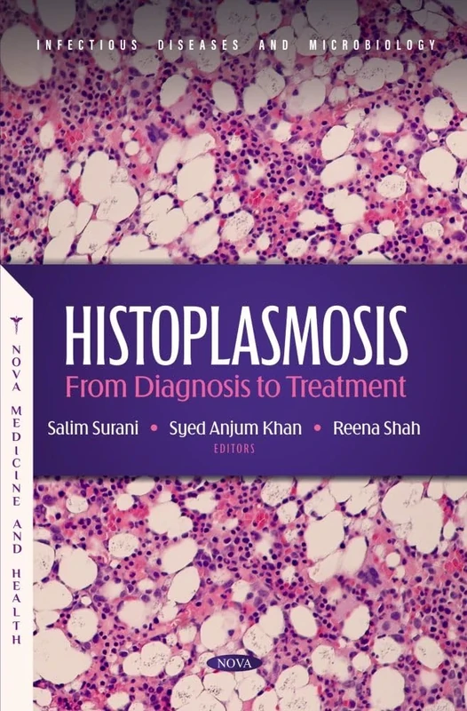 Histoplasmosis: From Diagnosis to Treatment (Infectious Diseases and Microbiology Series)
