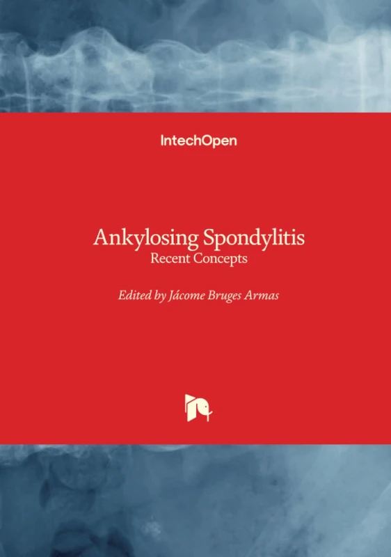 Ankylosing Spondylitis - Recent Concepts