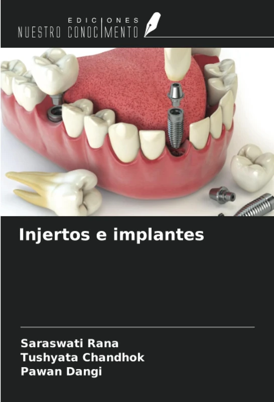 Injertos e implantes