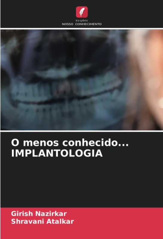 O menos conhecido... IMPLANTOLOGIA