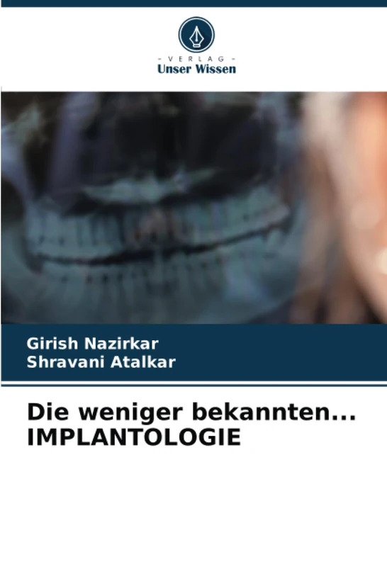 Die weniger bekannten... IMPLANTOLOGIE