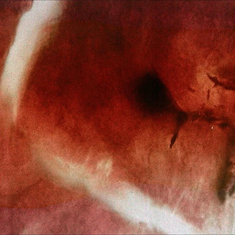 The Death of Kalypso [VINYL]