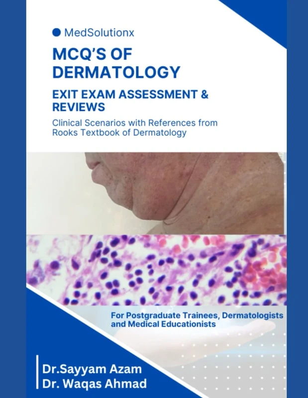 MCQ's BOOK OF DERMATOLOGY FOR POST GRADUATE TRAINEES: EXAM ASSESSMENT & REVIEWS