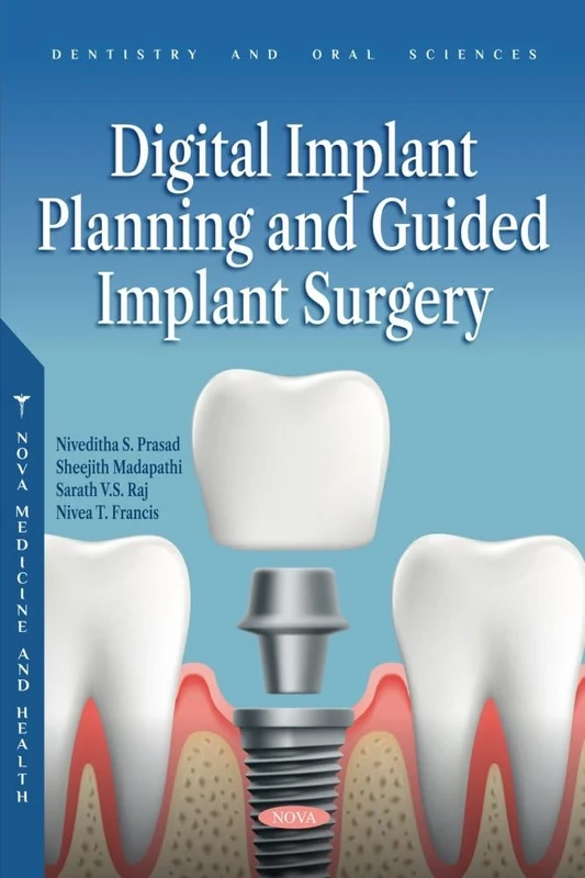 Digital Implant Planning and Guided Implant Surgery (Dentistry and Oral Sciences Series)