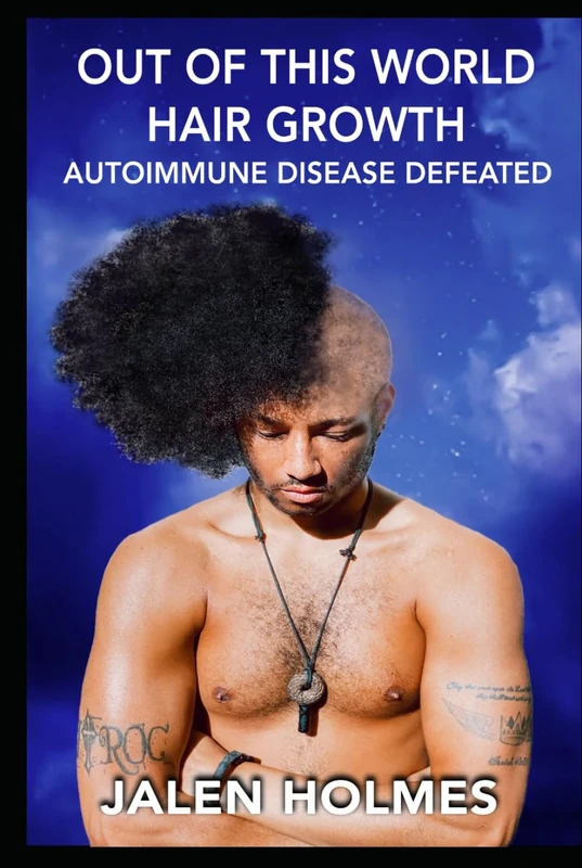 Out Of This World Hair Growth: Autoimmune Disease Defeated