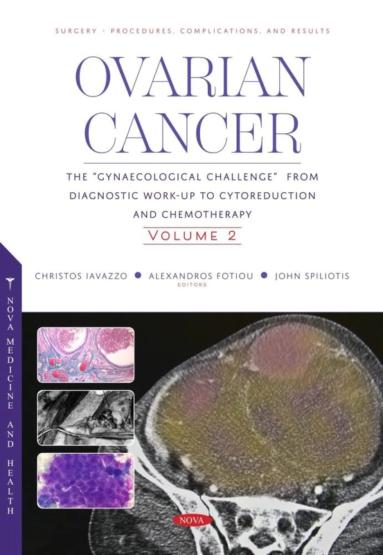 Ovarian Cancer: The “Gynaecological Challenge” from Diagnostic Work-Up to Cytoreduction and Chemotherapy. Volume 2 (Surgery - Procedures, ... to ... - Procedures, Complications, and Results)