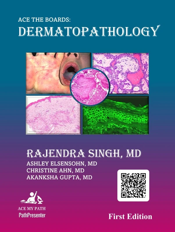 Ace The Boards: Dermatopathology (Ace My Path)