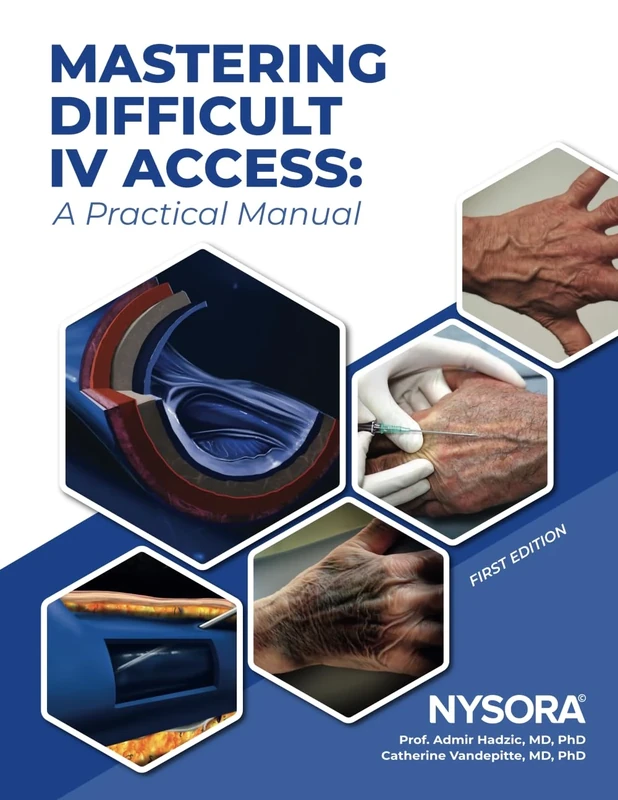 Mastering Difficult IV Access - a Practical Manual: First Edition