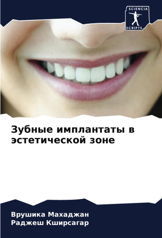 Зубные имплантаты в эстетической зоне