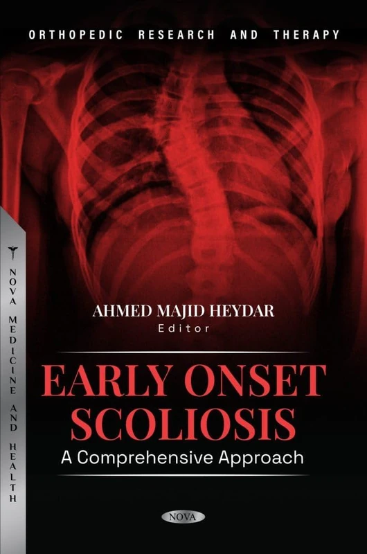 Early Onset Scoliosis: A Comprehensive Approach (Orthopedic Research and Therapy Series)