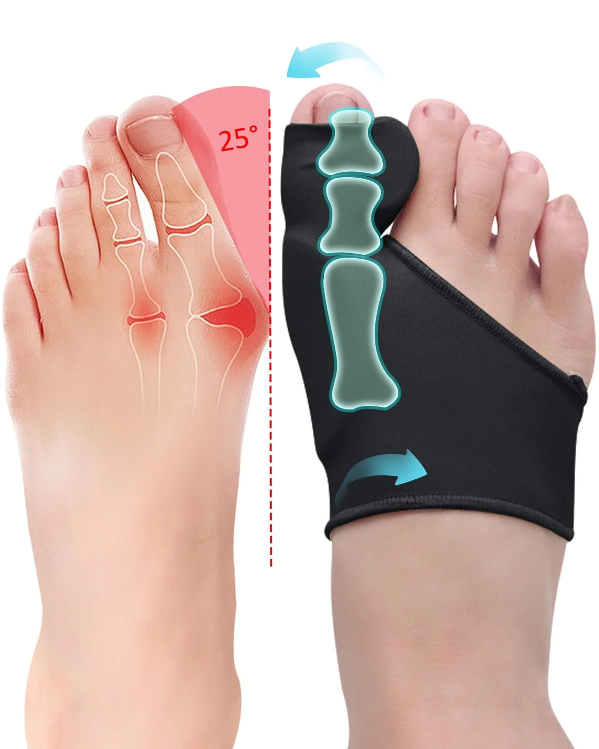 PGRODE 2 Pcs Bunion Corrector for Women Men Bunion Pain Relief, Big Toe Straighteners, Breathable Bunion Correction Socks with Built-in Gel Pad, Big Toe Spacer Separators (Black)