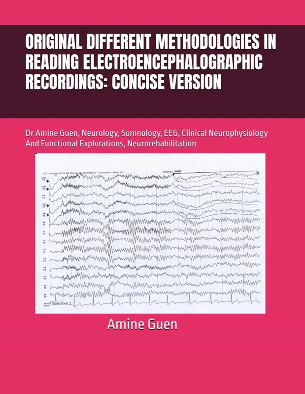 Original Methodologies in Reading EEG Recordings - Dr Amine Guen