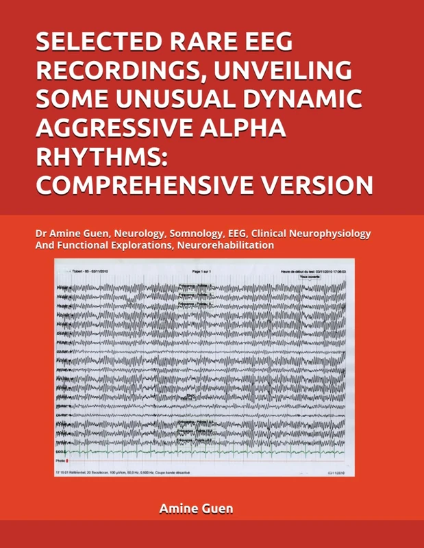 Selected Rare EEG Recordings - Dr Amine Guen Neurology Book
