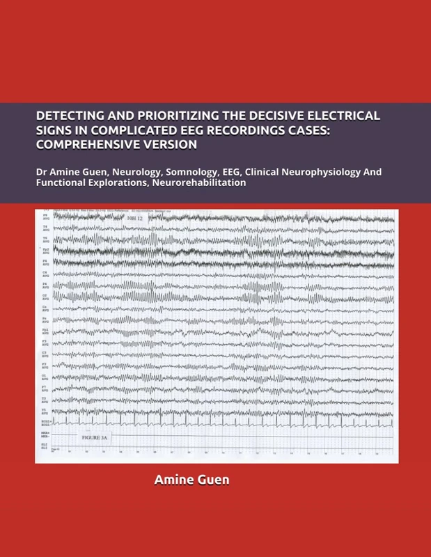 DETECTING AND PRIORITIZING THE DECISIVE ELECTRICAL SIGNS IN COMPLICATED EEG RECORDINGS CASES: COMPREHENSIVE VERSION: Dr Amine Guen, Neurology, ... Functional Explorations, Neurorehabilitation