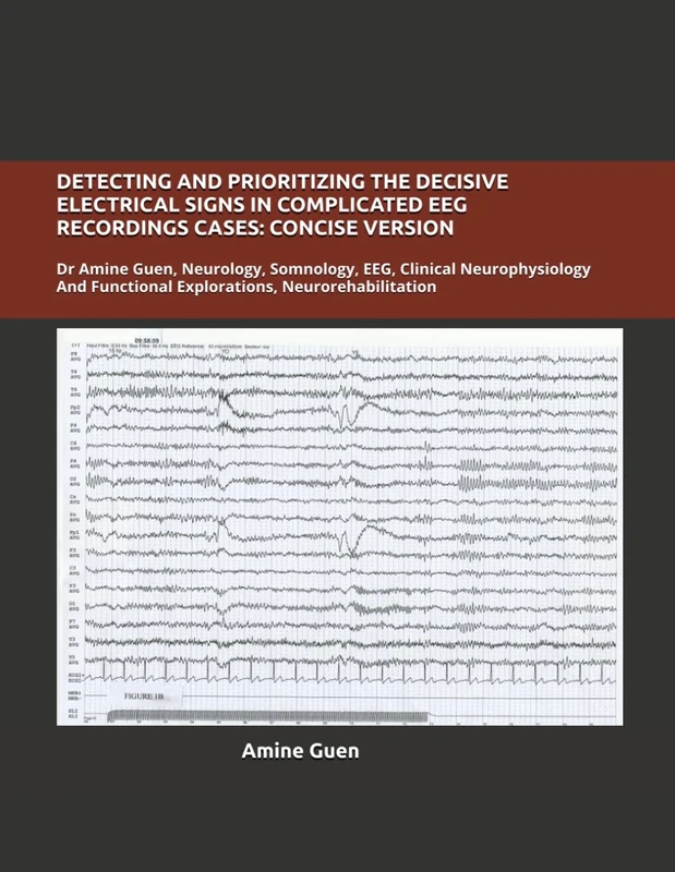 DETECTING AND PRIORITIZING THE DECISIVE ELECTRICAL SIGNS IN COMPLICATED EEG RECORDINGS CASES: CONCISE VERSION: Dr Amine Guen, Neurology, Somnology, ... Functional Explorations, Neurorehabilitation