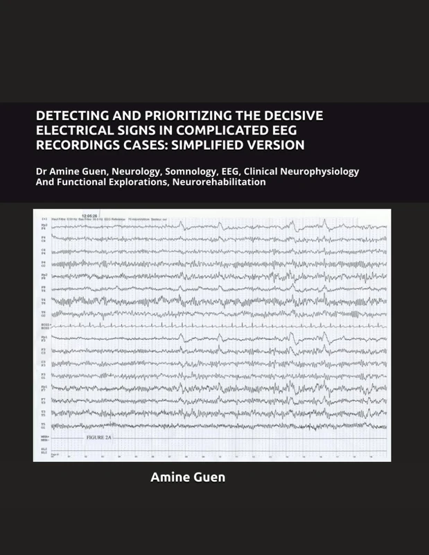 DETECTING AND PRIORITIZING THE DECISIVE ELECTRICAL SIGNS IN COMPLICATED EEG RECORDINGS CASES: SIMPLIFIED VERSION: Dr Amine Guen, Neurology, Somnology, ... Functional Explorations, Neurorehabilitation