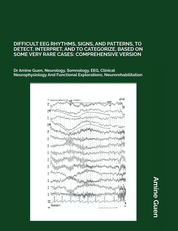 Difficult EEG Rhythms, Signs, and Patterns - Comprehensive Version