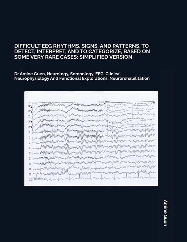 DIFFICULT EEG RHYTHMS, SIGNS, AND PATTERNS, TO DETECT, INTERPRET, AND TO CATEGORIZE, BASED ON SOME VERY RARE CASES: SIMPLIFIED VERSION: Dr Amine Guen, ... Functional Explorations, Neurorehabilitation