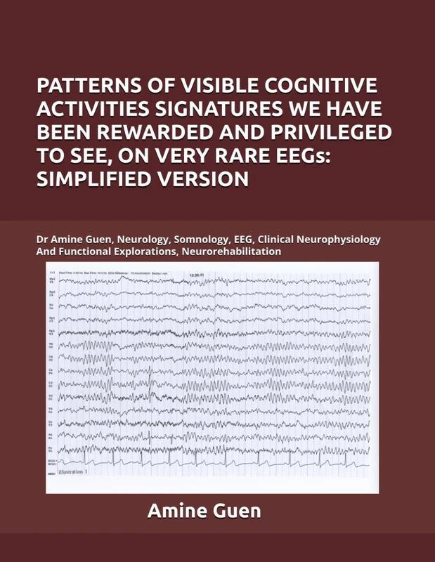 PATTERNS OF VISIBLE COGNITIVE ACTIVITIES SIGNATURES WE HAVE BEEN REWARDED AND PRIVILEGED TO SEE, ON VERY RARE EEGs: SIMPLIFIED VERSION: Dr Amine Guen, ... Functional Explorations, Neurorehabilitation
