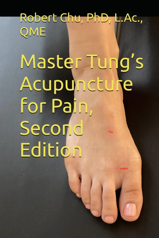 Master Tung’s Acupuncture for Pain, Second Edition