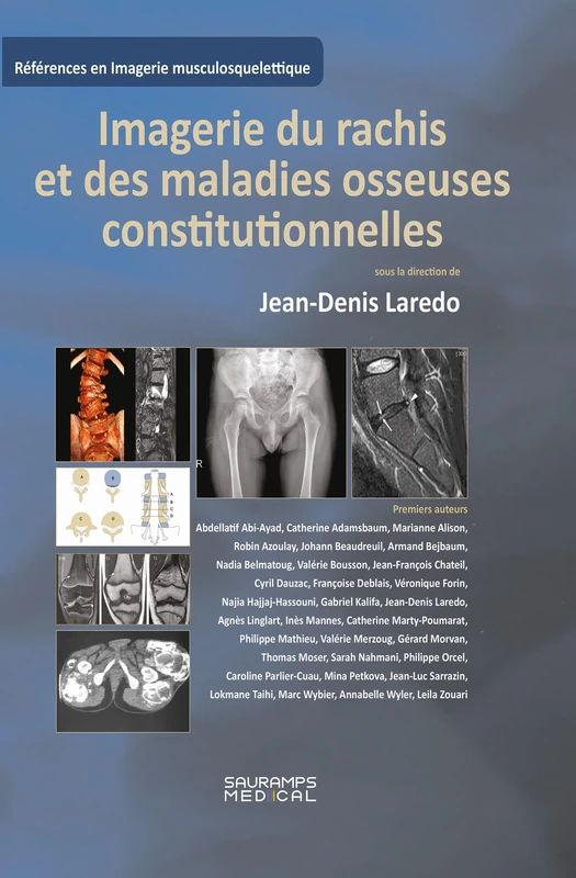 Imagerie du rachis et des maladies osseuses constitutionnelles: Rachis de l'adulte et maladies osseuses de l'enfant vues à l'âge adulte
