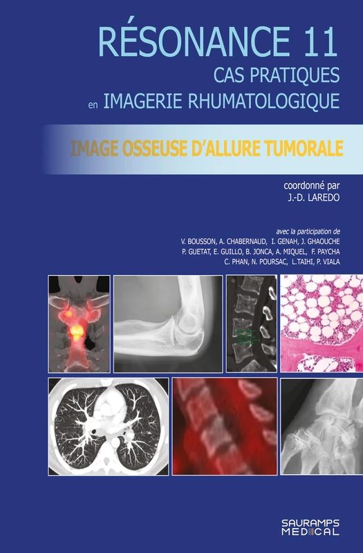 Résonance 11 - Imagerie osseuse d'allure tumorale: Cas pratiques en imagerie musculosquelettique