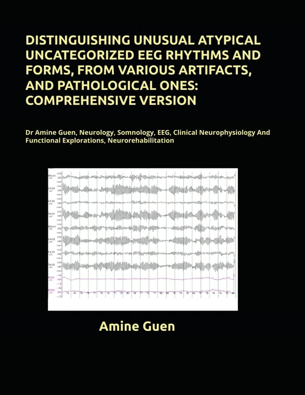 EEG Rhythms and Artifacts - Dr Amine Medical Neurology Book