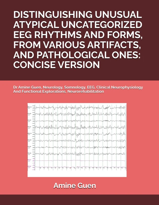 DISTINGUISHING UNUSUAL ATYPICAL UNCATEGORIZED EEG RHYTHMS AND FORMS, FROM VARIOUS ARTIFACTS, AND PATHOLOGICAL ONES: CONCISE VERSION: Dr Amine Guen, ... Functional Explorations, Neurorehabilitation