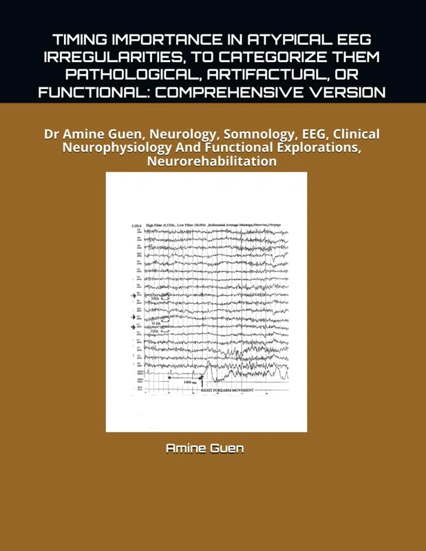 TIMING IMPORTANCE IN ATYPICAL EEG IRREGULARITIES, TO CATEGORIZE THEM PATHOLOGICAL, ARTIFACTUAL, OR FUNCTIONAL: COMPREHENSIVE VERSION: Dr Amine Guen, ... Functional Explorations, Neurorehabilitation