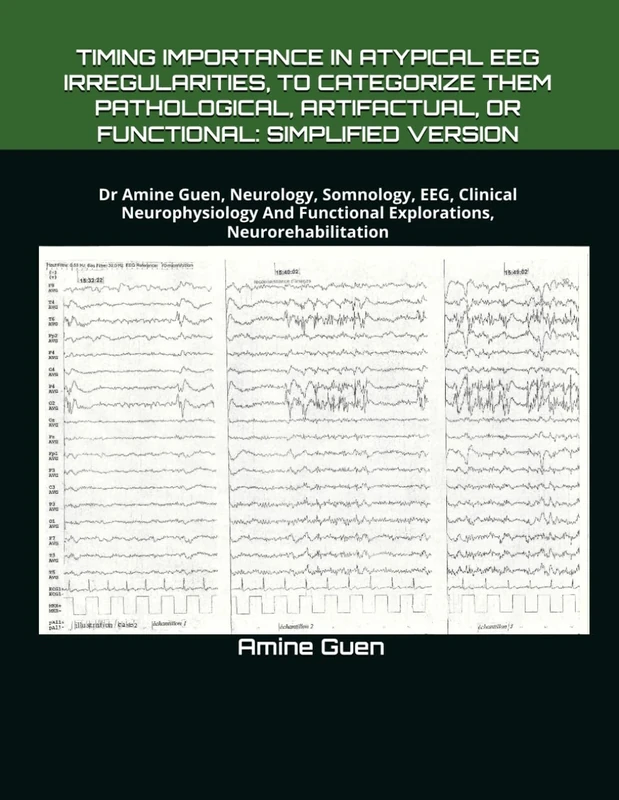 TIMING IMPORTANCE IN ATYPICAL EEG IRREGULARITIES, TO CATEGORIZE THEM PATHOLOGICAL, ARTIFACTUAL, OR FUNCTIONAL: SIMPLIFIED VERSION: Dr Amine Guen, ... Functional Explorations, Neurorehabilitation
