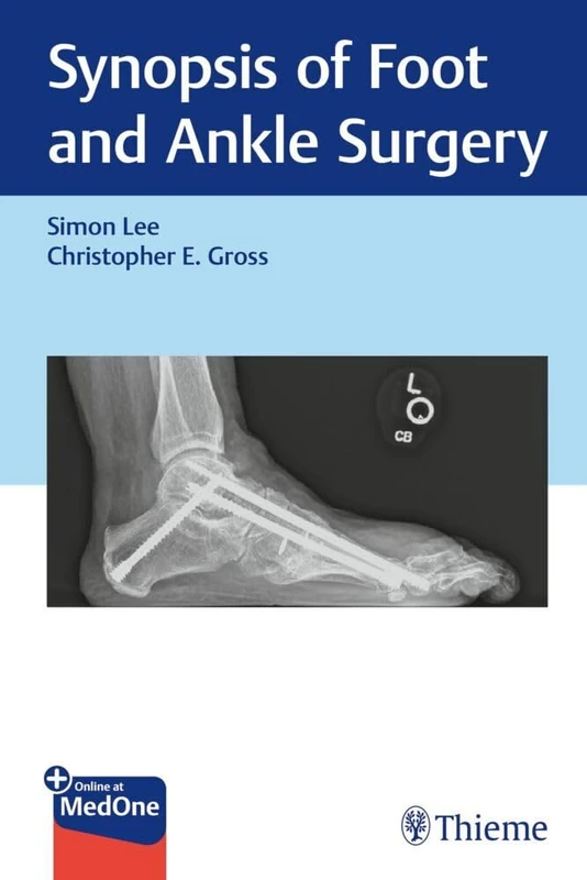 Synopsis of Foot and Ankle Surgery