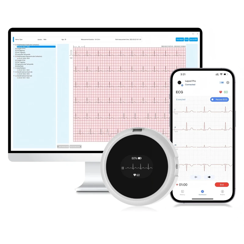 CheckMe LepodPro 12-Lead ECG with OLED Display, 24-Hour Real-Time ECG Recording, Detailed AI ECG Reporting, Event Marker Function, Smartphone APP and PC Support for Home Use with Lanyard