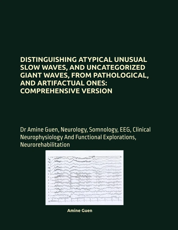 DISTINGUISHING ATYPICAL UNUSUAL SLOW WAVES, AND UNCATEGORIZED GIANT WAVES, FROM PATHOLOGICAL, AND ARTIFACTUAL ONES: COMPREHENSIVE VERSION: Dr Amine ... Functional Explorations, Neurorehabilitation